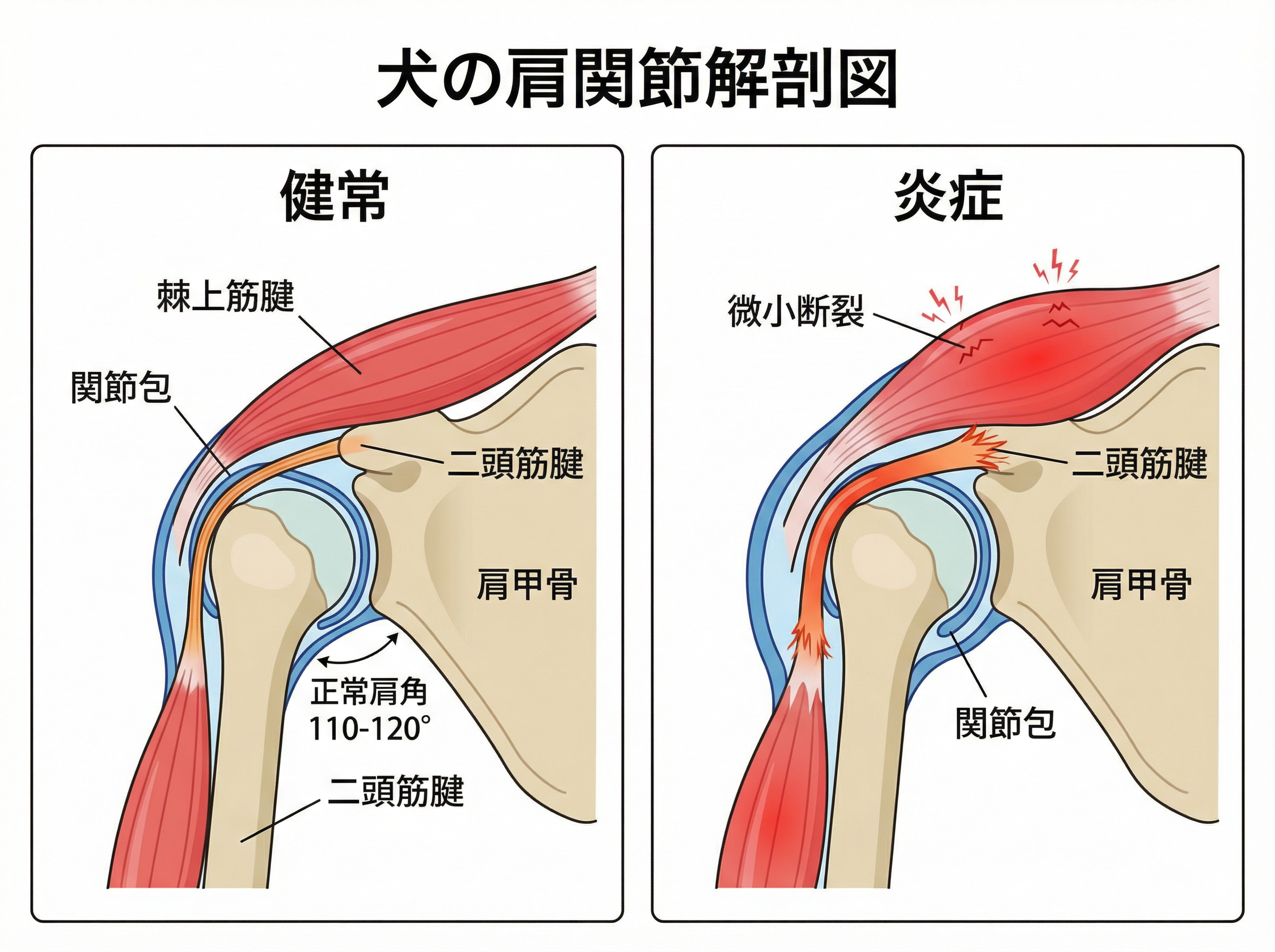 犬の肩関節解剖図：健常と炎症の比較