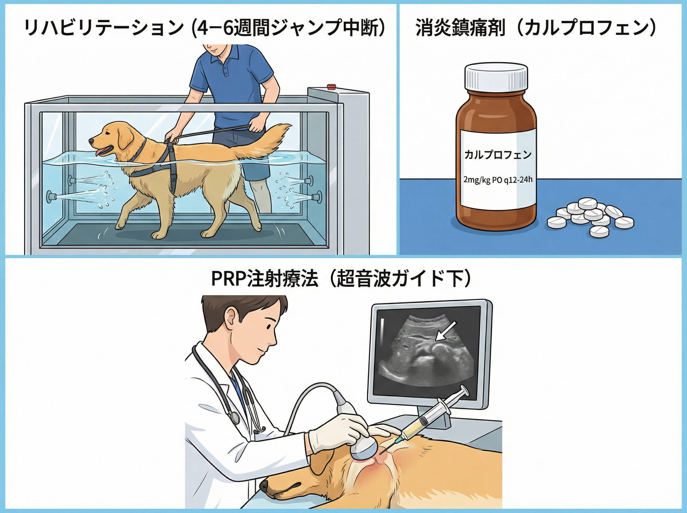 治療の選択肢：リハビリ・消炎鎮痛剤・PRP注射
